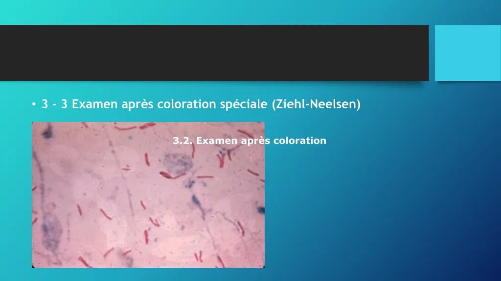 3 3 examen apr s coloration sp ciale ziehl neelsen