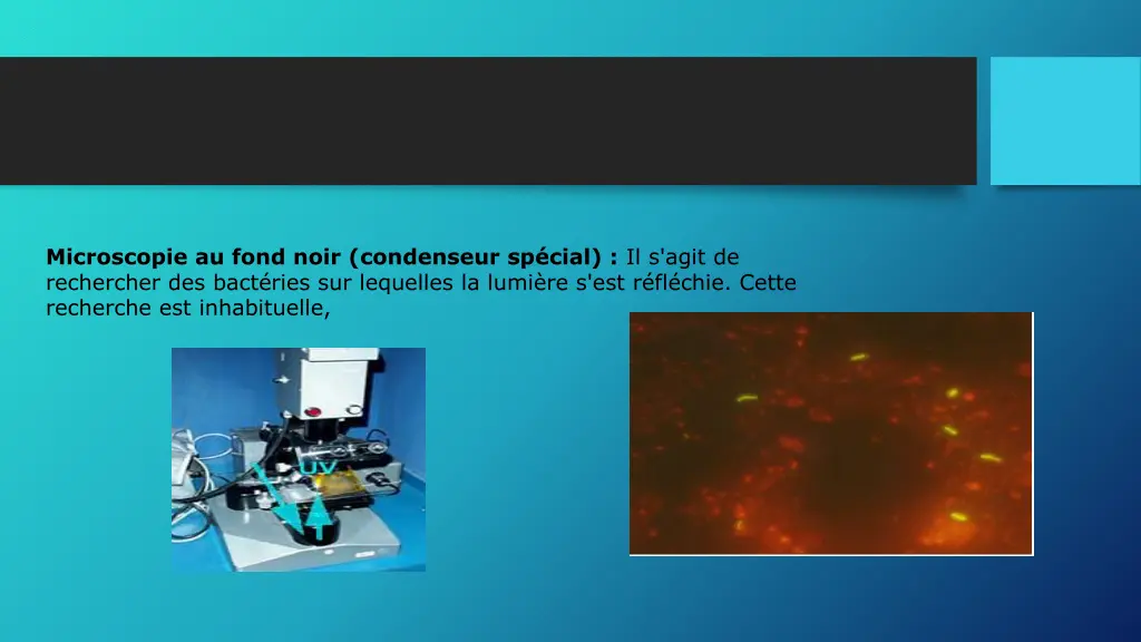 microscopie au fond noir condenseur sp cial