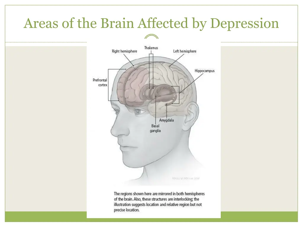 areas of the brain affected by depression