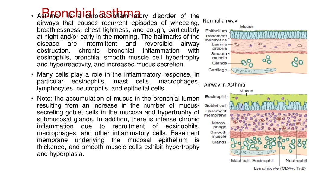 bronchial asthma asthma is a chronic inflammatory