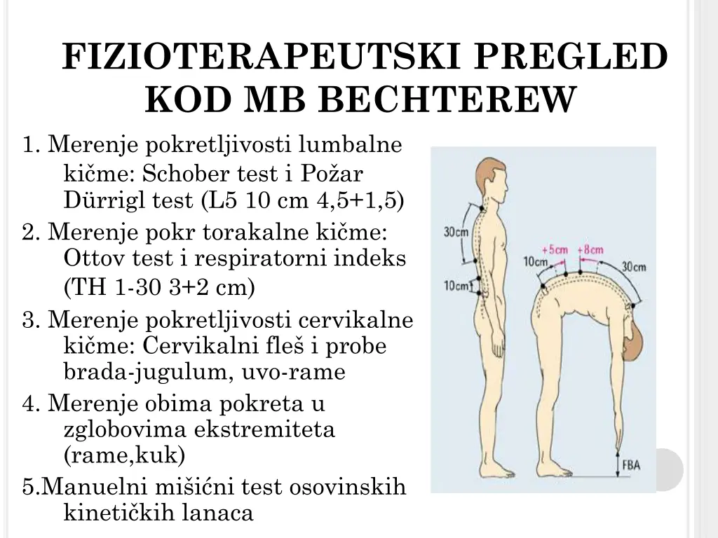 fizioterapeutski pregled kod mb bechterew
