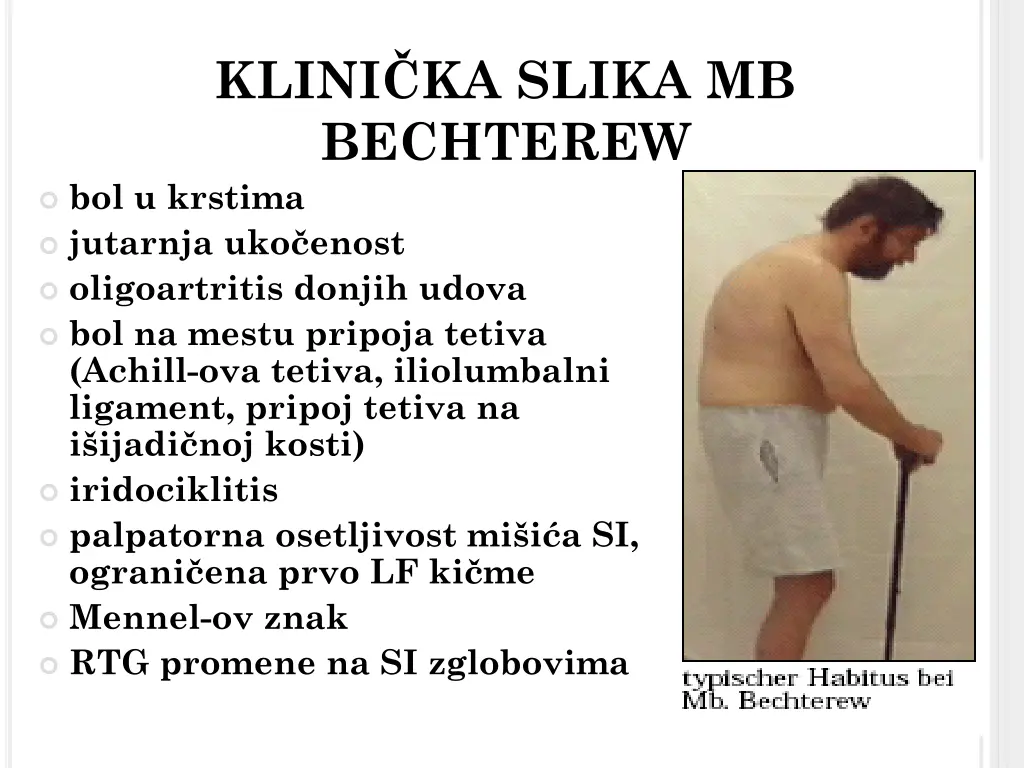 klini ka slika mb bechterew bol u krstima