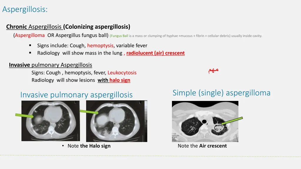 aspergillosis 1