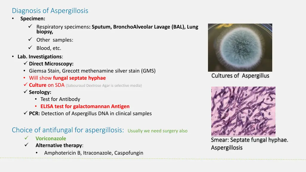 diagnosis of aspergillosis specimen respiratory