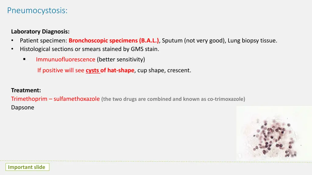 pneumocystosis