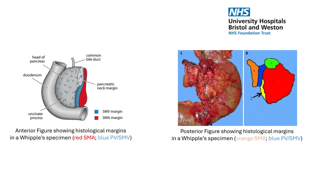 anterior figure showing histological margins