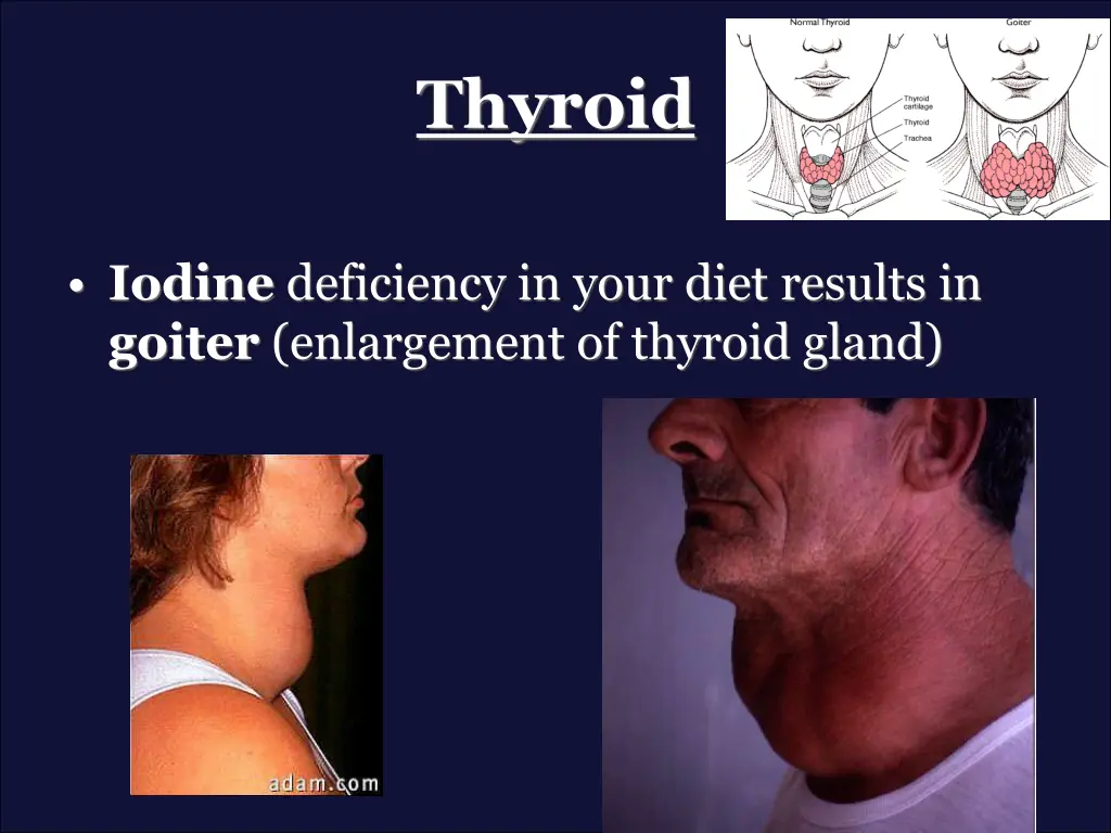thyroid 1