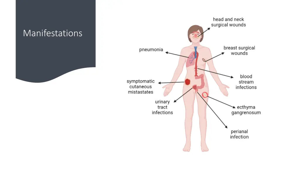 manifestations
