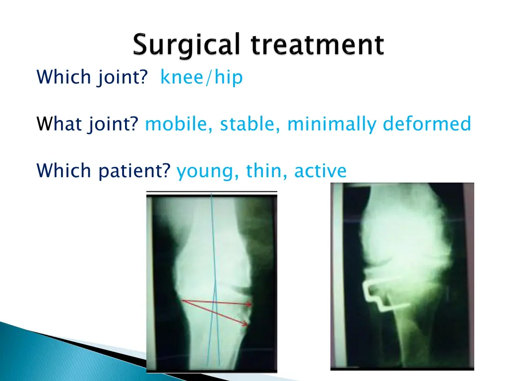which joint knee hip