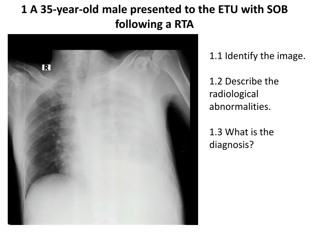 1 a 35 year old male presented to the etu with