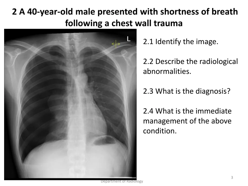 2 a 40 year old male presented with shortness