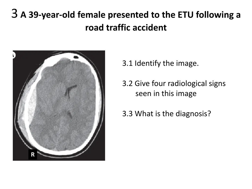 3 a 39 year old female presented