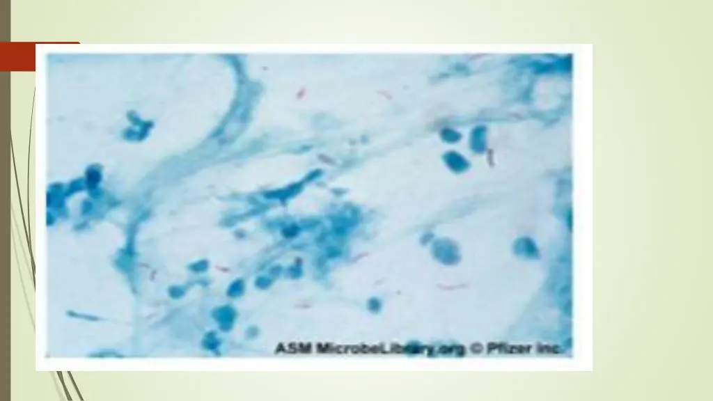 slide7