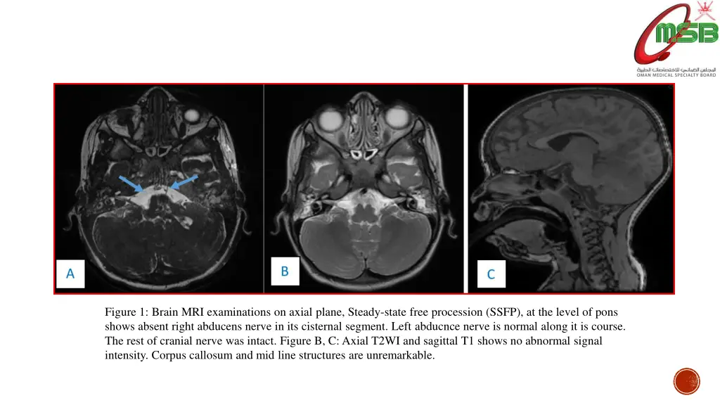 figure 1 brain mri examinations on axial plane