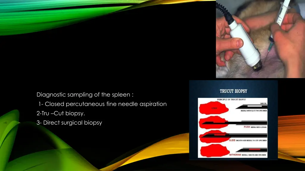diagnostic sampling of the spleen 1 closed