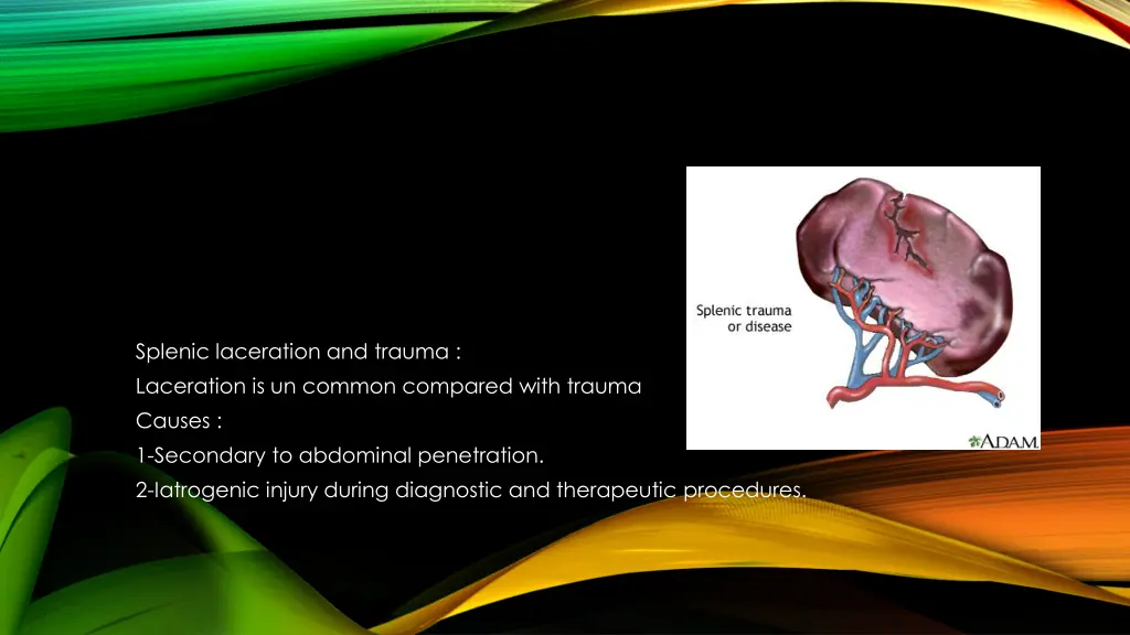 splenic laceration and trauma laceration