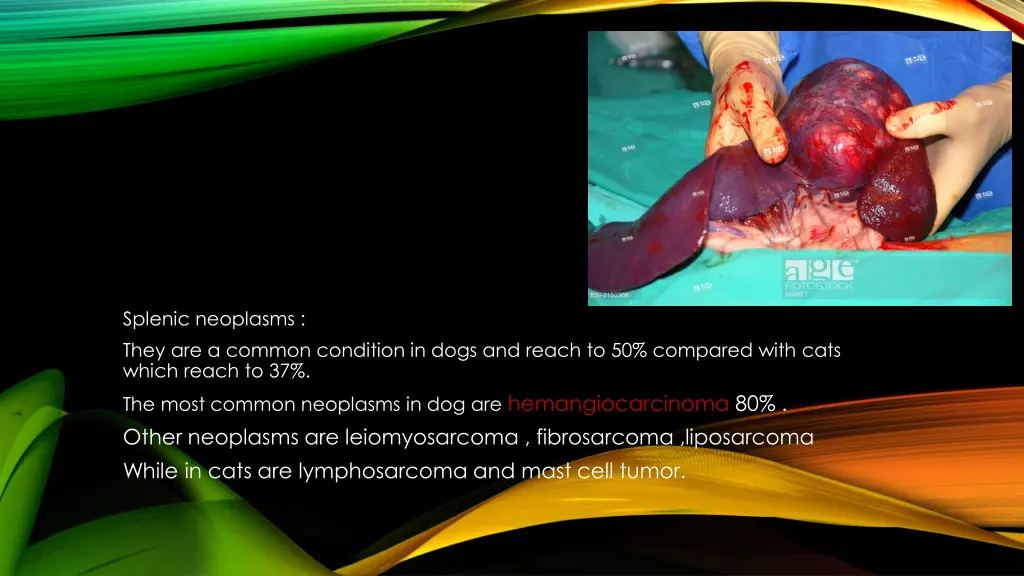 splenic neoplasms they are a common condition
