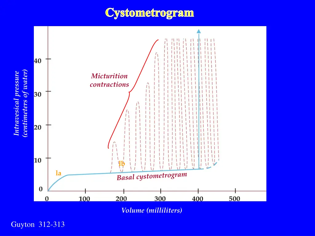cystometrogram