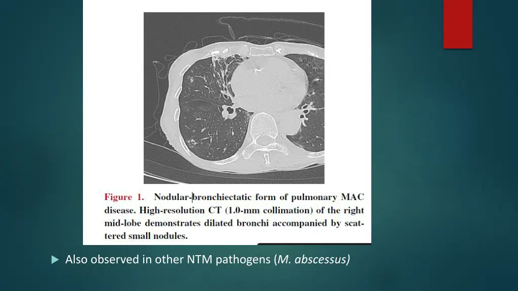 also observed in other ntm pathogens m abscessus