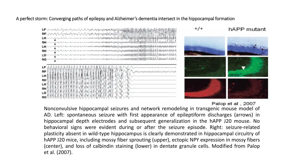 a perfect storm converging paths of epilepsy 1