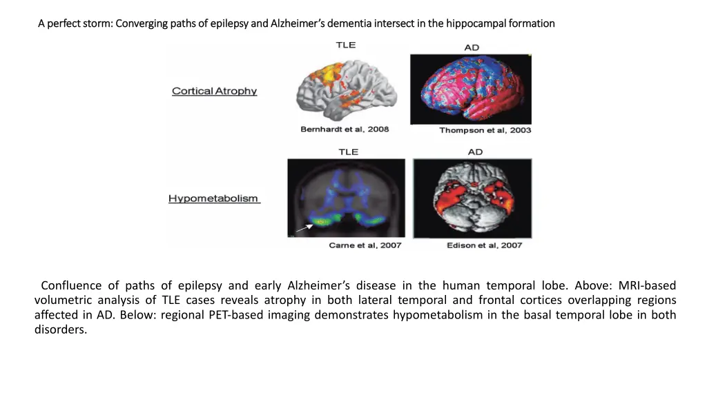 a perfect storm converging paths of epilepsy 2