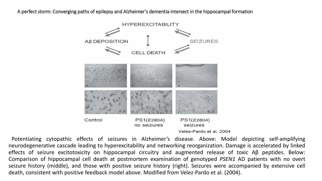 a perfect storm converging paths of epilepsy 3
