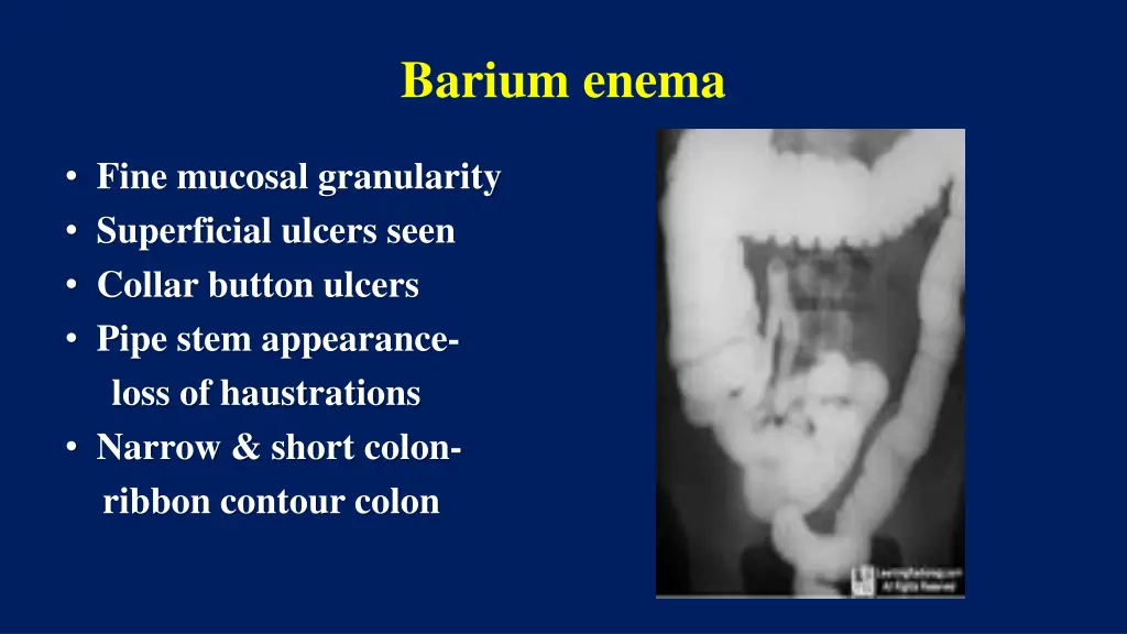 barium enema 1