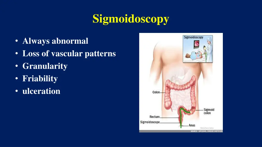 sigmoidoscopy