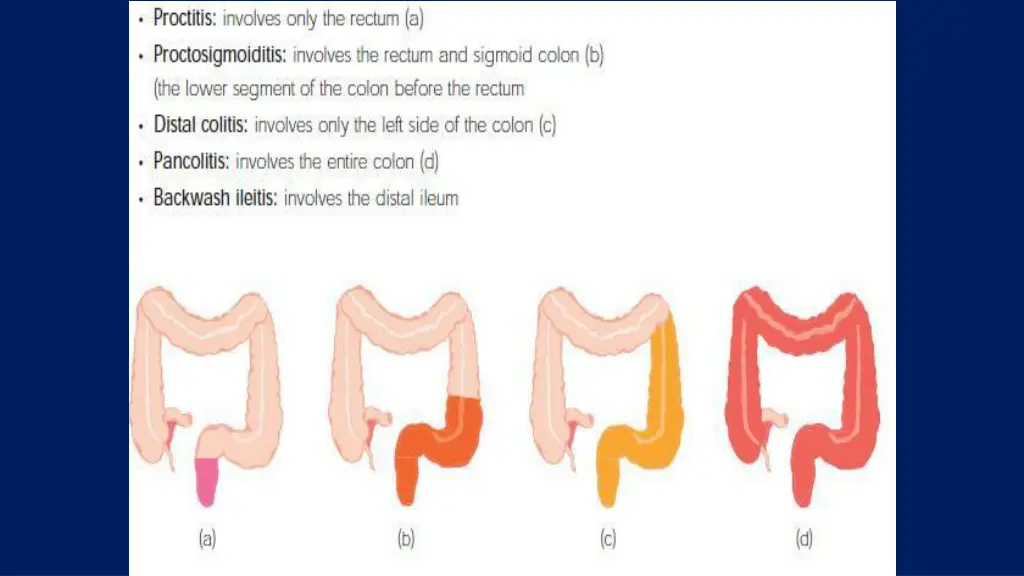 slide7