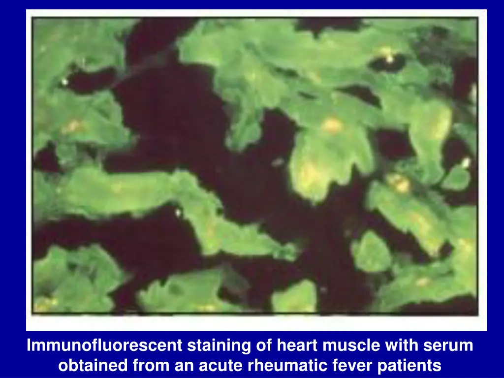 immunofluorescent staining of heart muscle with