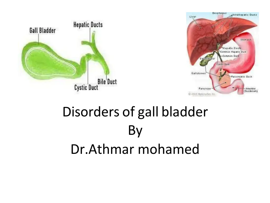 disorders of gall bladder by dr athmar mohamed