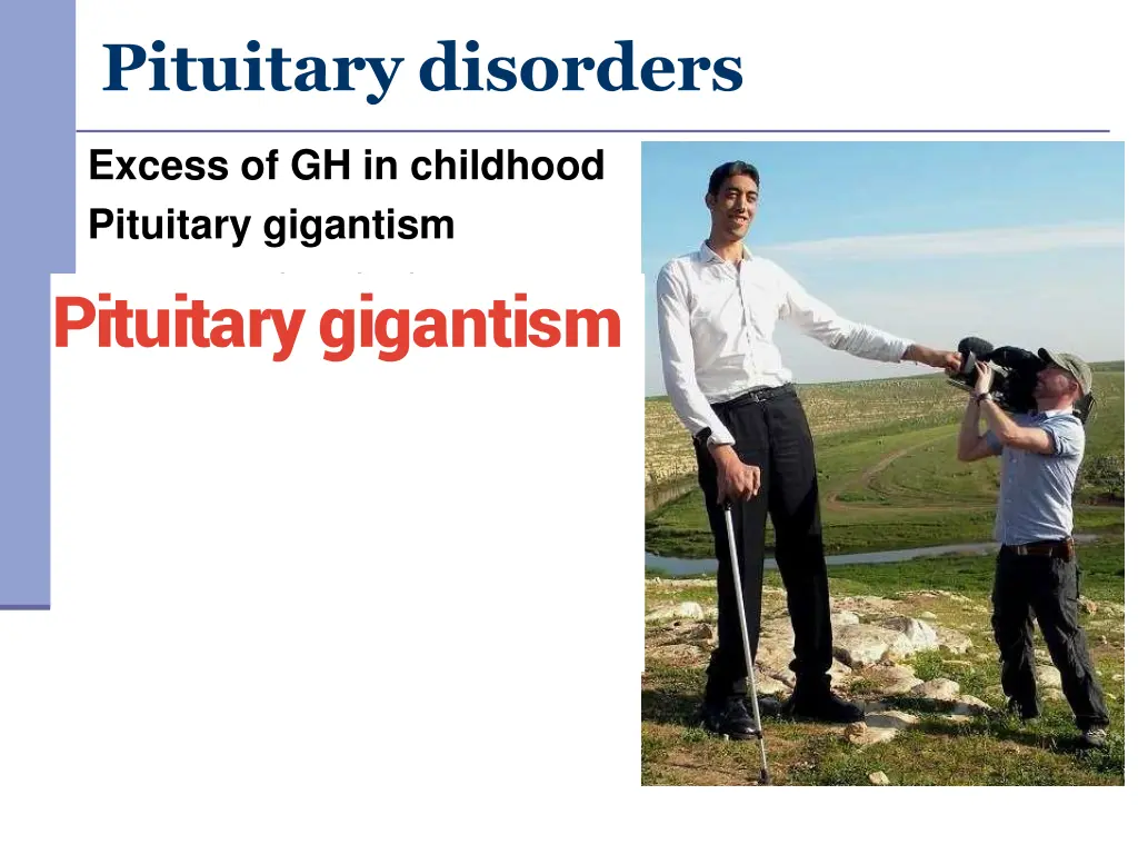 pituitary disorders 2