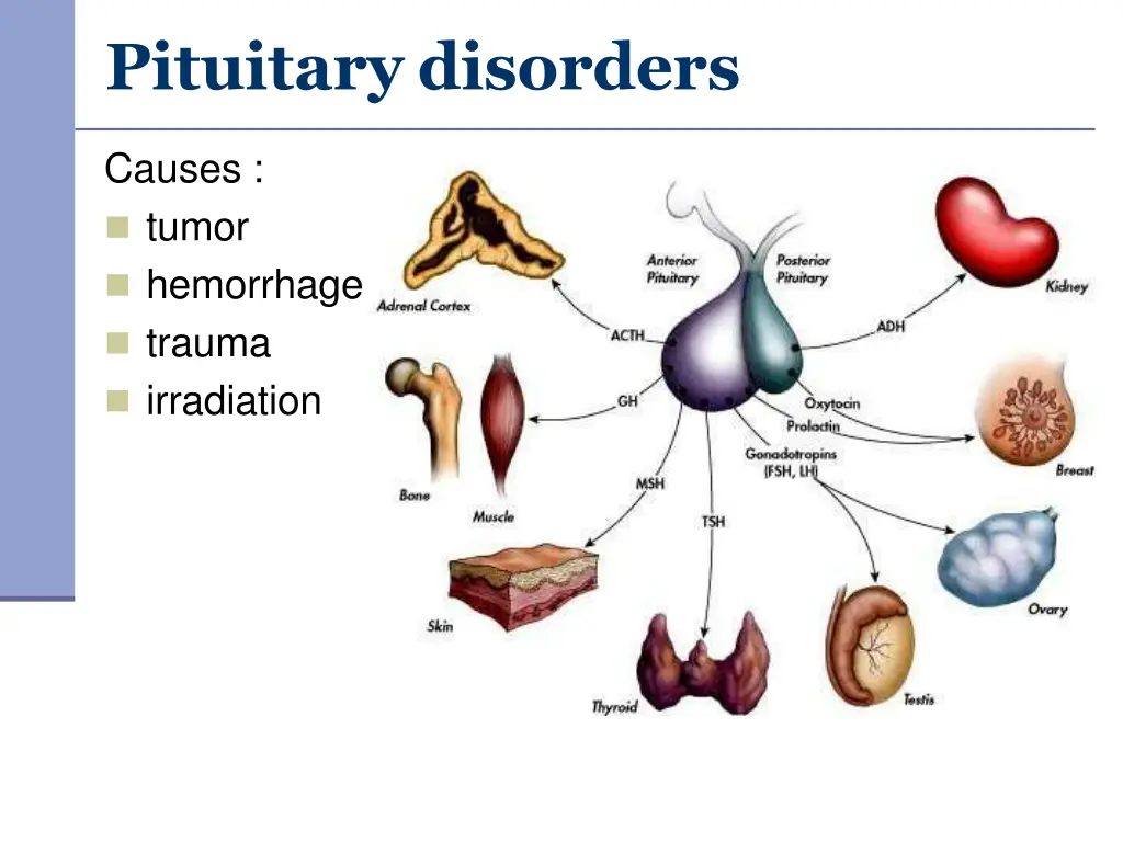 pituitary disorders