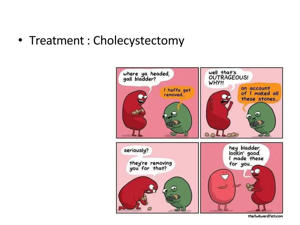 treatment cholecystectomy