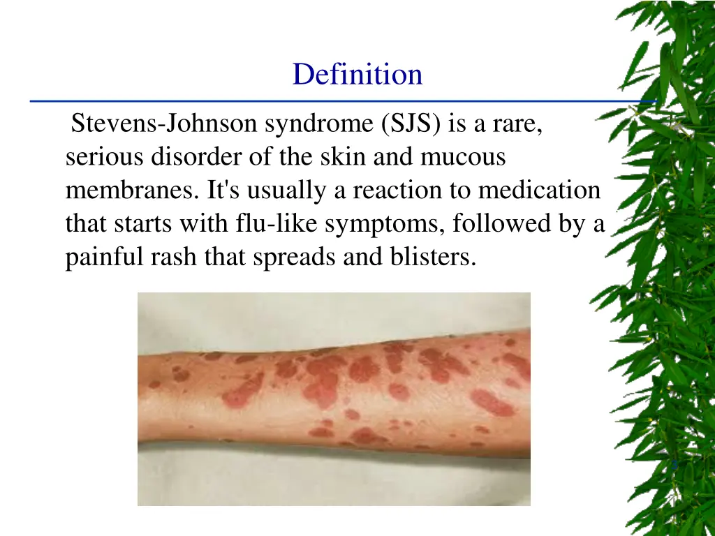 definition