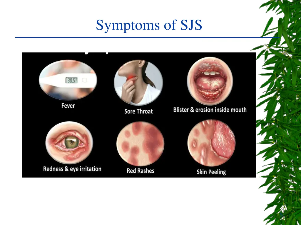 symptoms of sjs