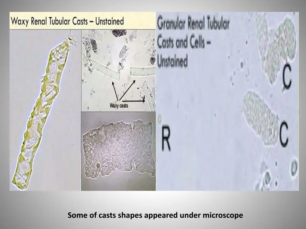 some of casts shapes appeared under microscope