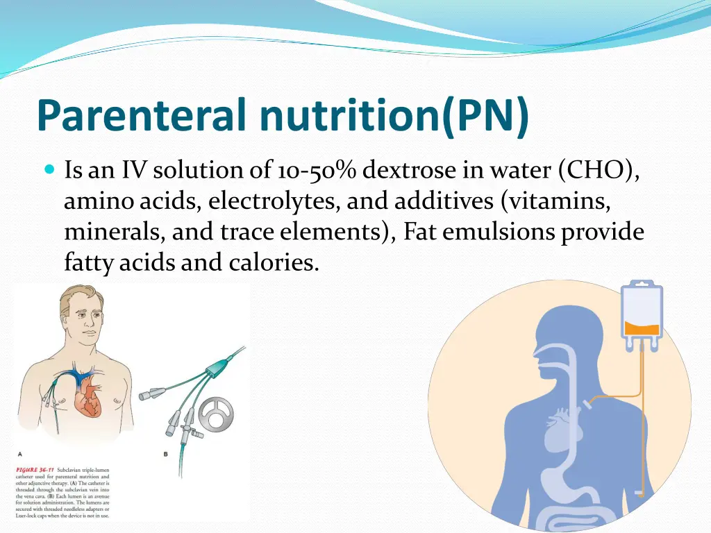 parenteral nutrition pn