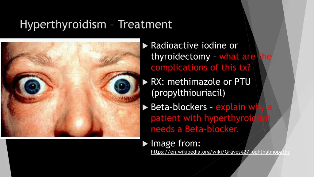 hyperthyroidism treatment