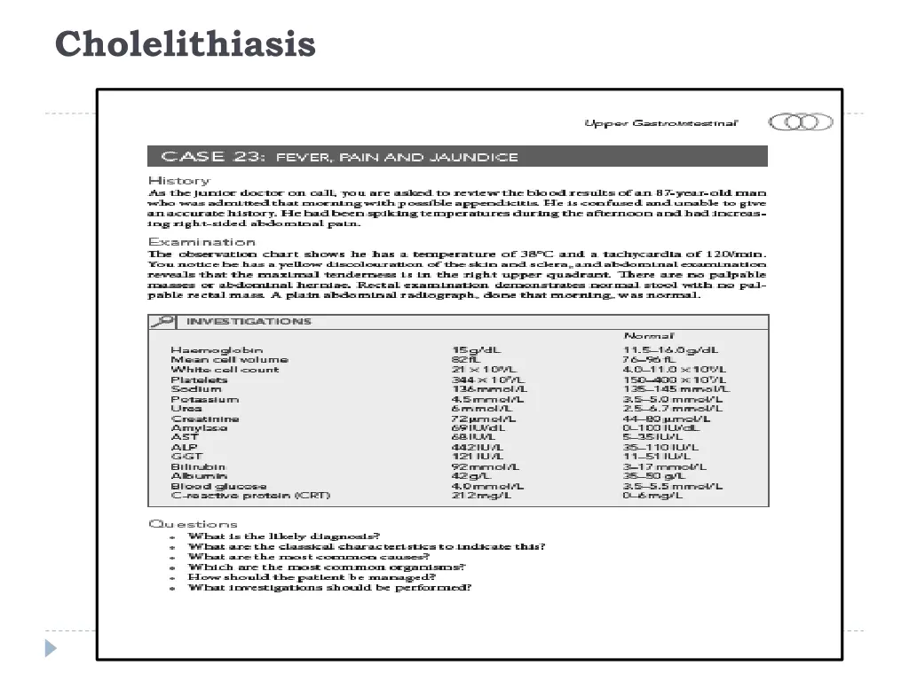 cholelithiasis