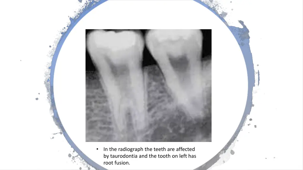 slide10