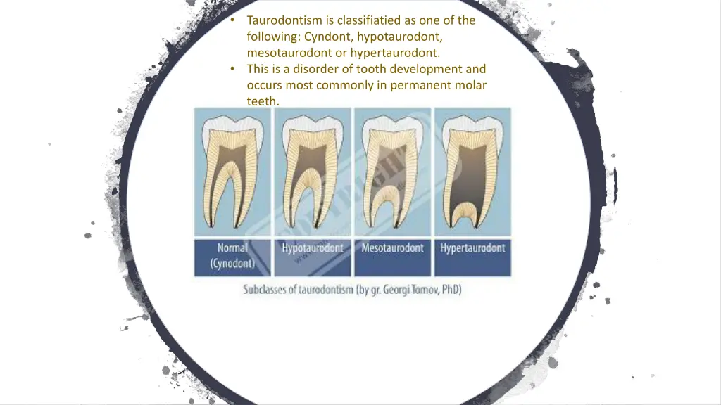 slide3