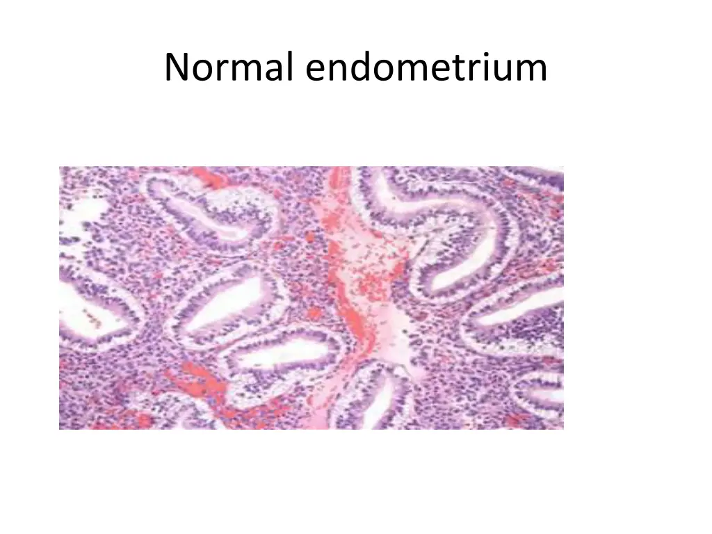 normal endometrium