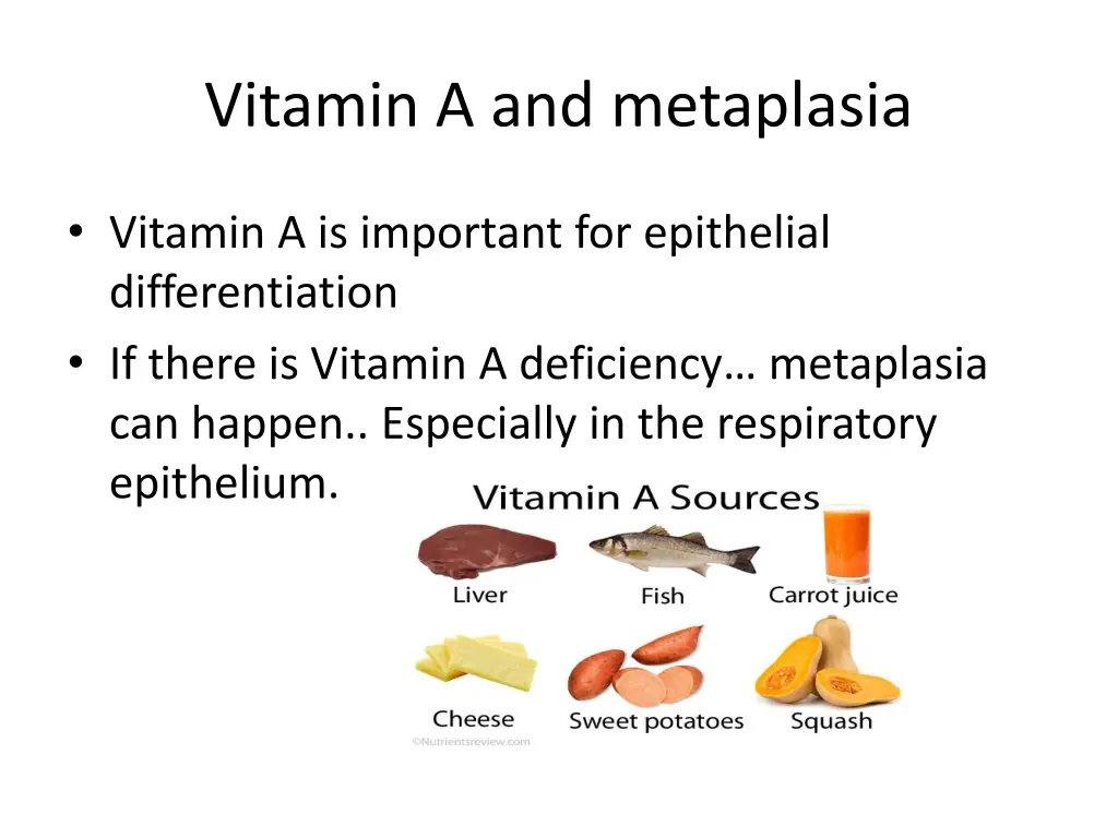 vitamin a and metaplasia