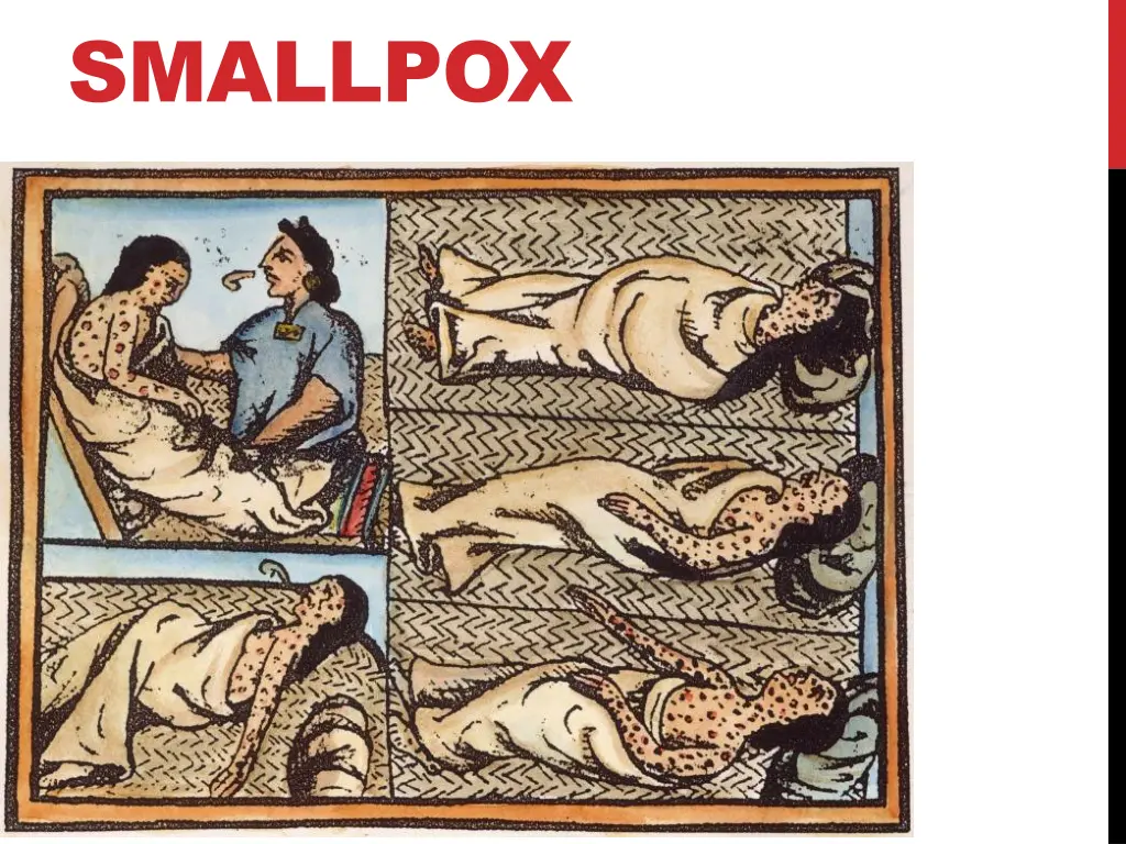 smallpox