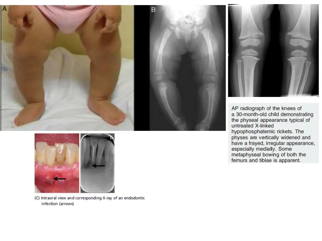 slide6