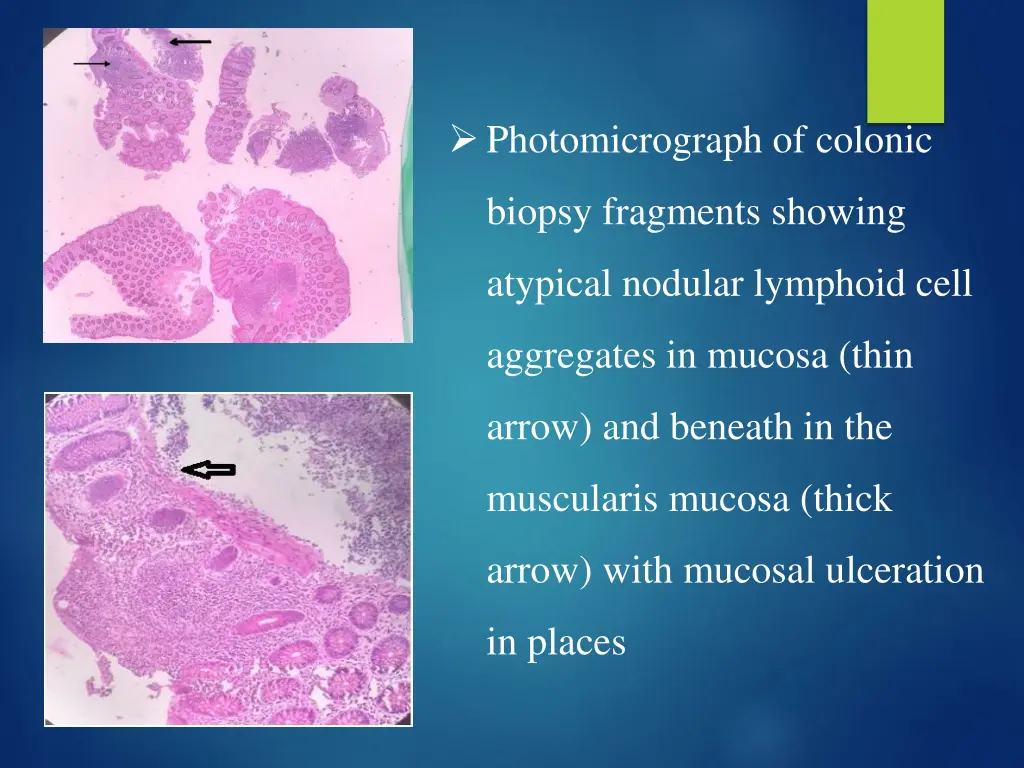photomicrograph of colonic