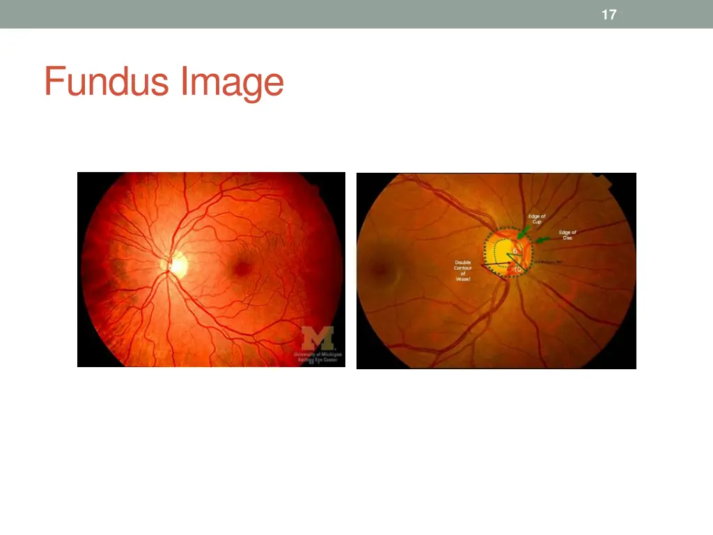 slide17