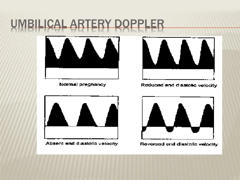 umbilical artery doppler