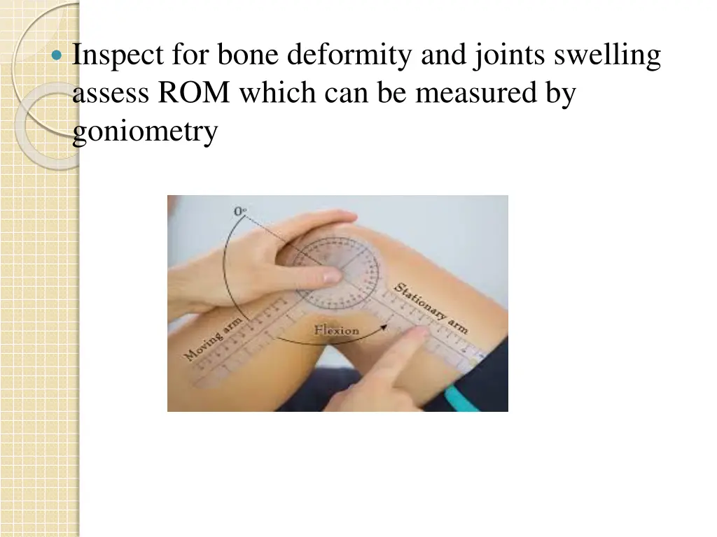 inspect for bone deformity and joints swelling